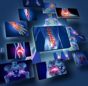 APS Therapy pain locations